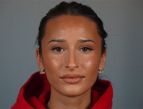 Case #768 Before image