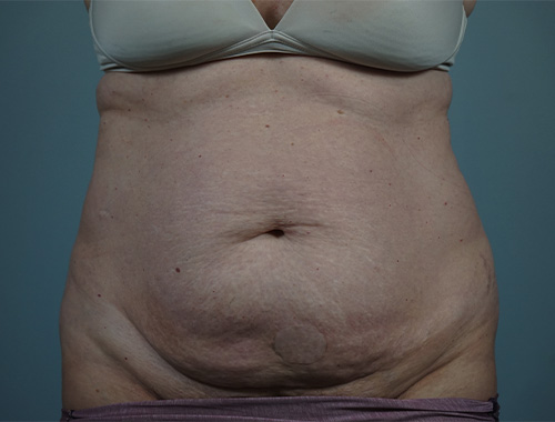 Case #764 Before image