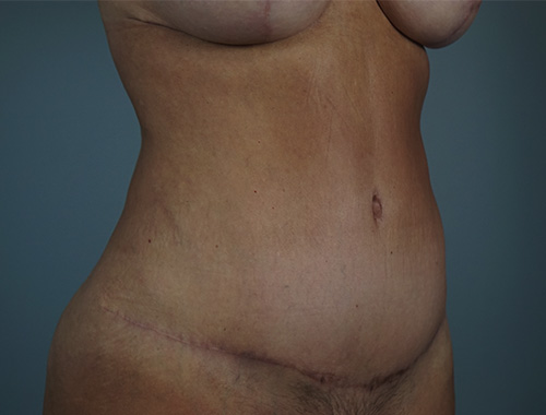 Case #765 After image