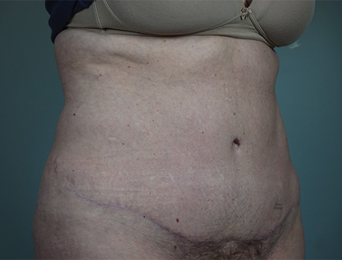 Case #764 After image