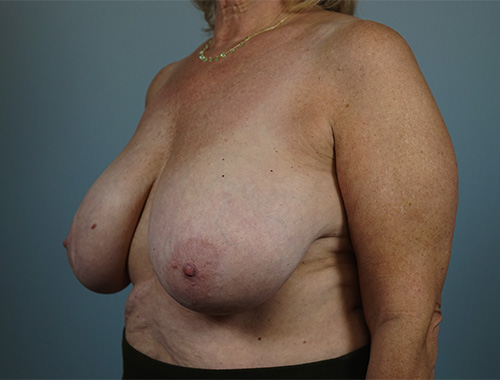 Case #766 Before image