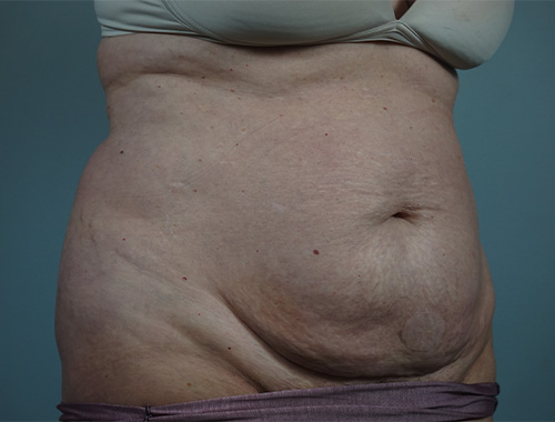 Case #764 Before image