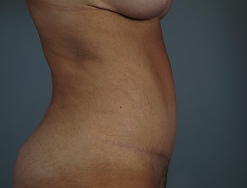 Case #765 After image