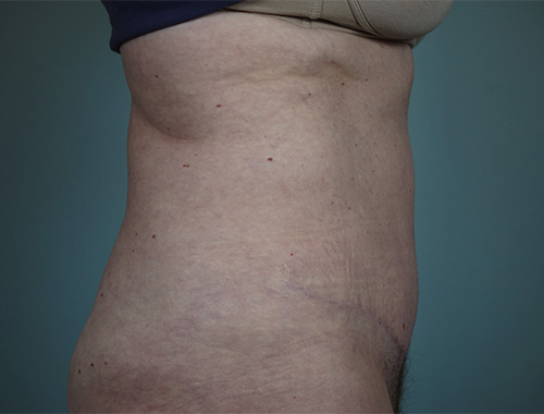 Case #764 After image