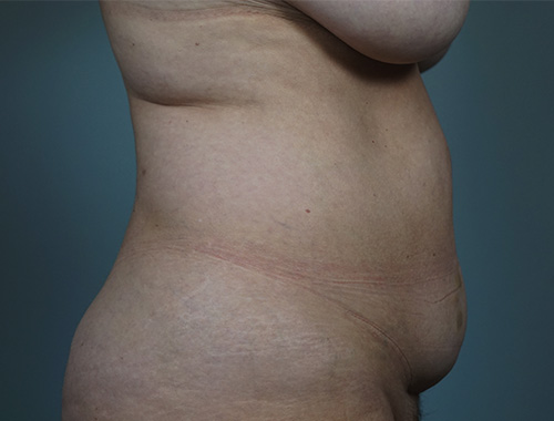 Case #765 Before image