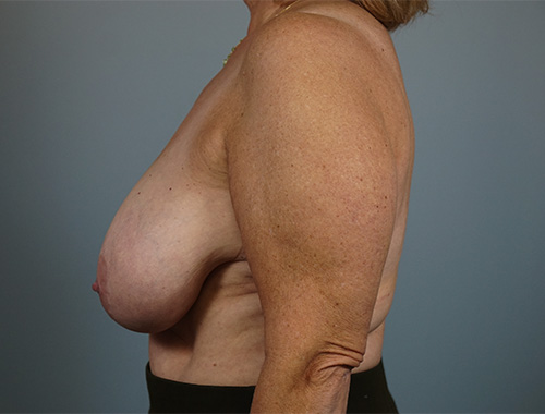 Case #766 Before image
