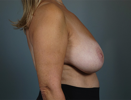 Case #767 Before image