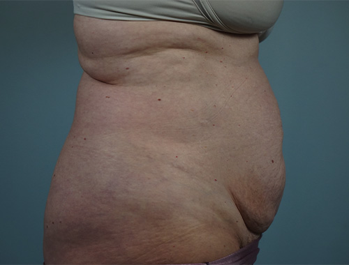 Case #764 Before image