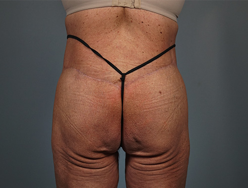 Case #771 After image