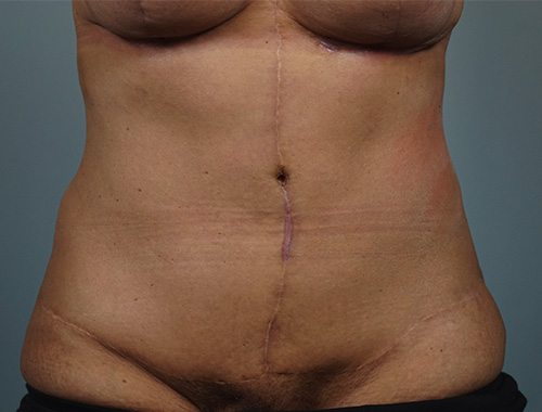 Case #769 After image