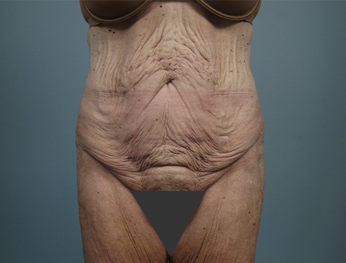 Case #771 Before image