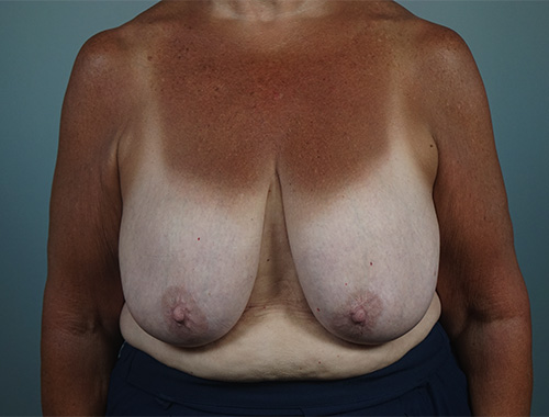 Case #773 Before image