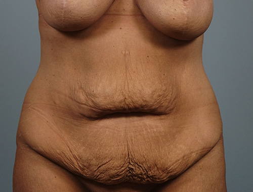 Case #769 Before image