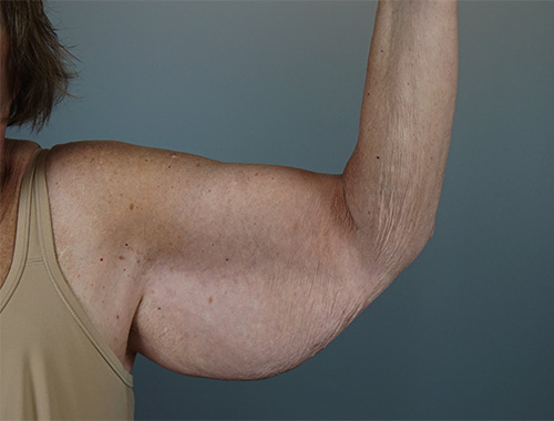Case #770 Before image