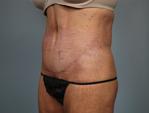 Case #771 After image