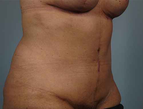 Case #769 After image