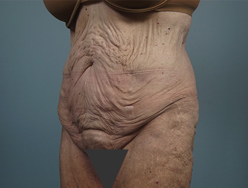 Case #771 Before image