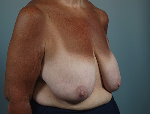 Case #773 Before image