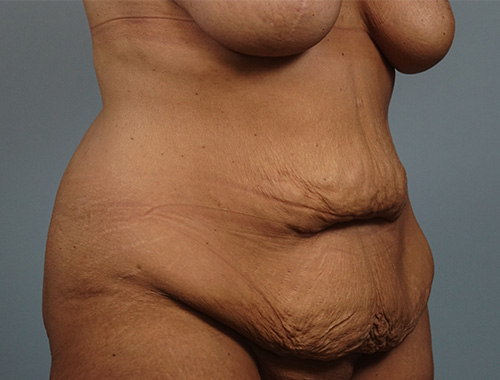Case #769 Before image
