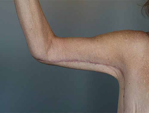 Case #770 After image