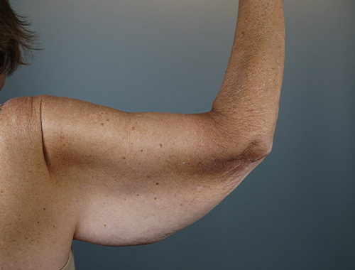 Case #770 Before image