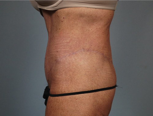 Case #771 After image