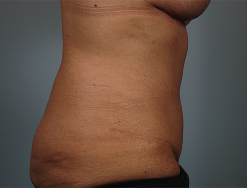 Case #769 After image