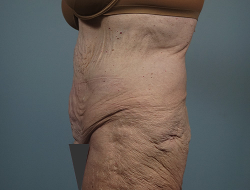 Case #771 Before image