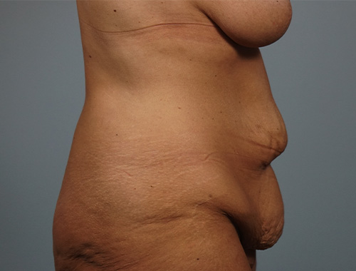 Case #769 Before image